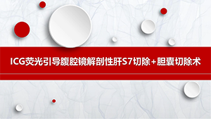ICG荧光引导腹腔镜解剖性肝S7切除+胆囊切除术