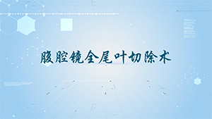 腹腔镜下扩大全尾叶切除术（全尾叶联合左内叶）