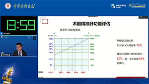 荧光腹腔镜下右肝后叶切除术