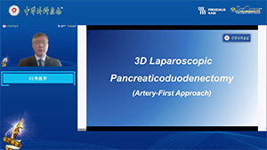 腹腔镜胰十二指肠切除（动脉入路）